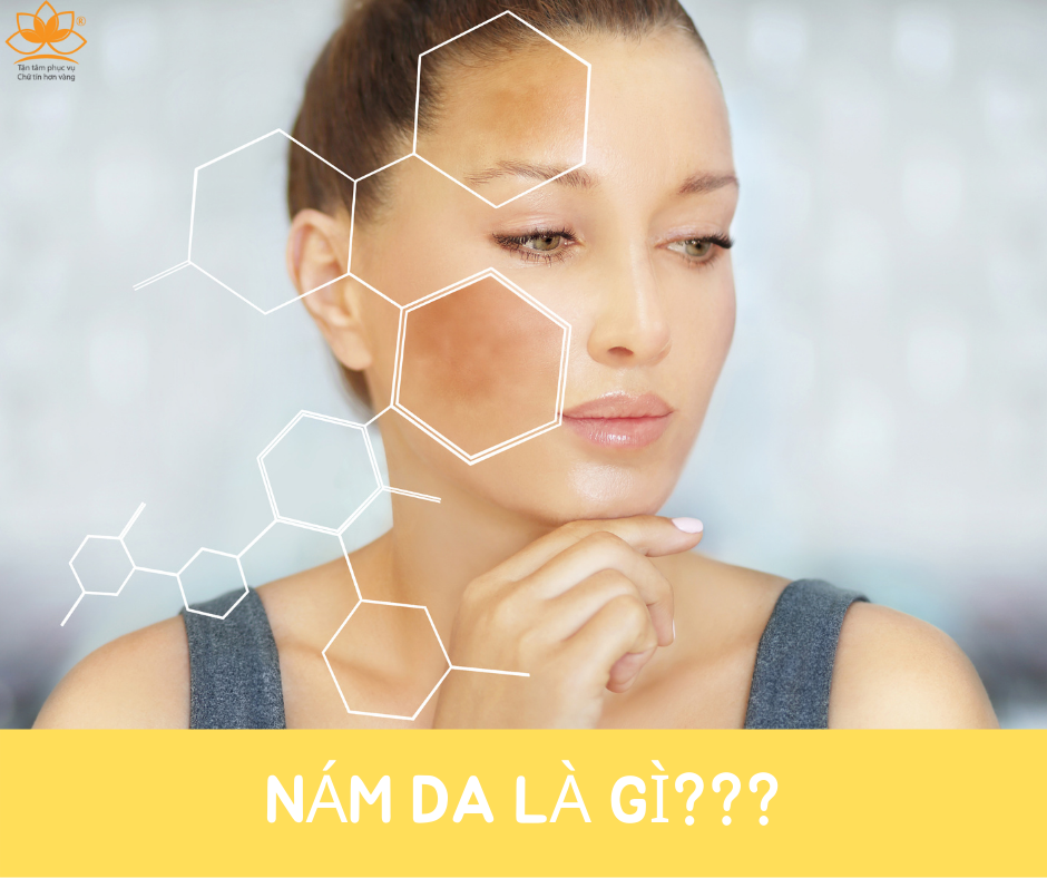NÁM DA LÀ GÌ?